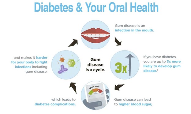 Diabetes and your oral health